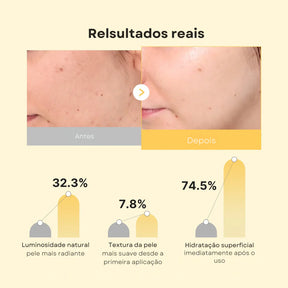 Máscara Jelly Dourada com Ácido Kójico e Cúrcuma - Kit com 4 Mascara