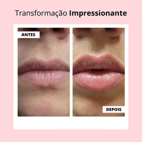 Lip Booster - Lábios Volumosos Naturalmente