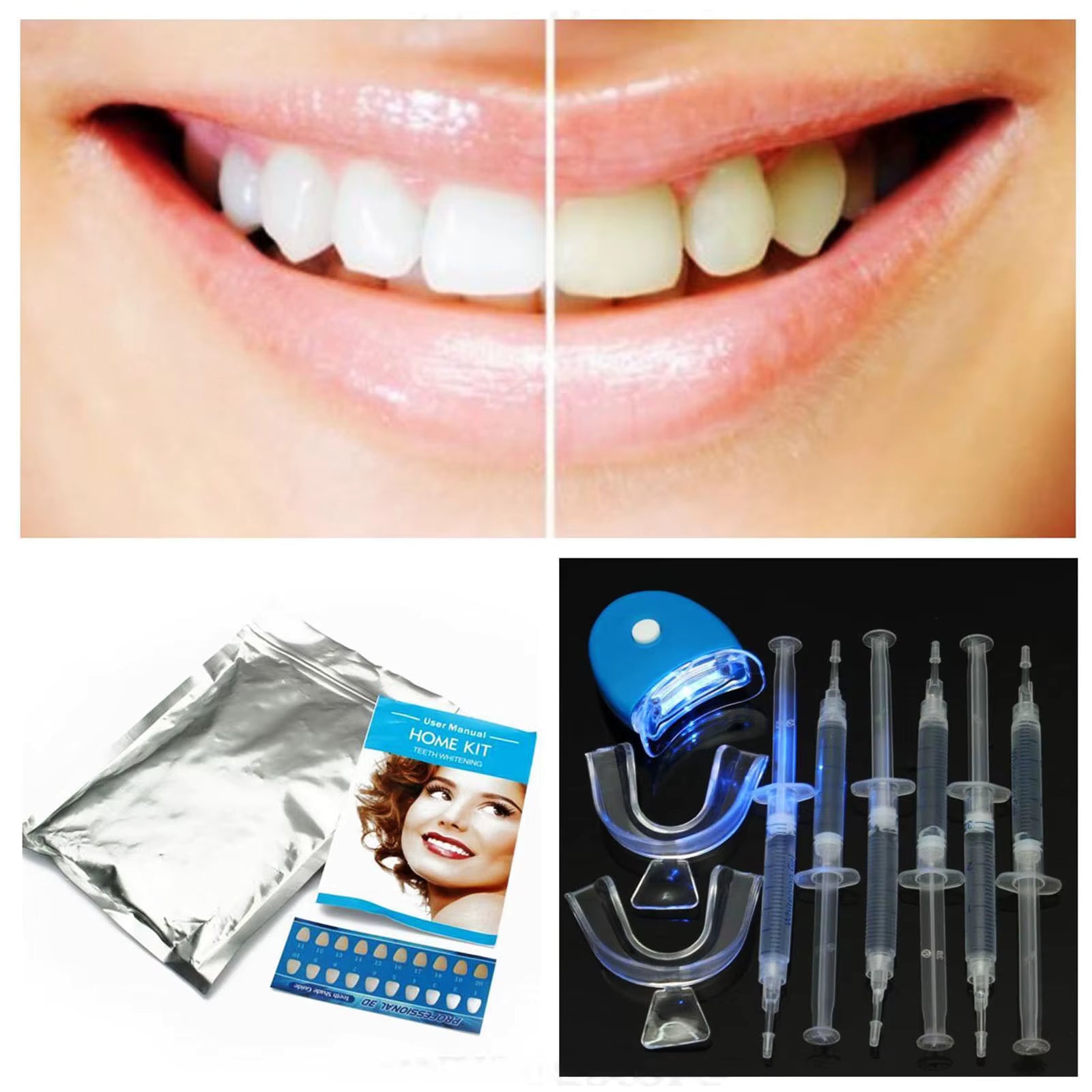 Clareamento Dental Smile - ''Segredo das Influencer que elas não te falam.''