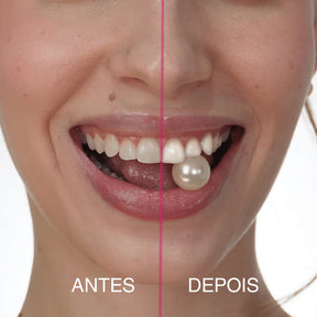 Fita Clareadora PAP + Smilie [POUCAS UNIDADES]